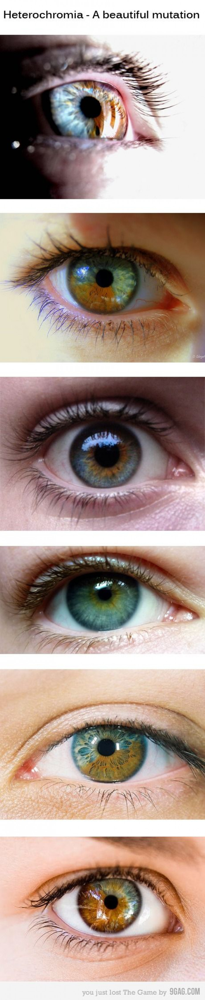Heterochromia A Beautiful Mutation Ladblab 